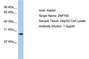 Host: Rabbit Target Name: ZNF763 Sample Type: HepG2 Whole cell lysates Antibody Dilution: 1.