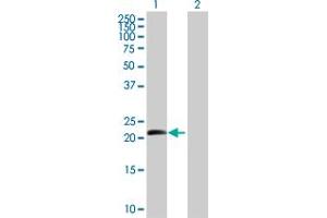 Western Blot analysis of BTC expression in transfected 293T cell line by BTC MaxPab polyclonal antibody. (Betacellulin antibody  (AA 1-178))