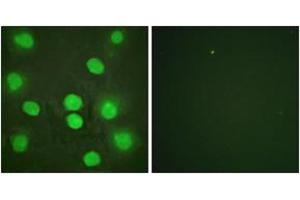 Immunofluorescence analysis of HuvEc cells, using GATA4 (Ab-262) Antibody. (GATA4 antibody  (AA 228-277))