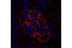 Immunostaining of a paraffin embedded mouse kidney section (dilution 1 : 200; red). (SYNPO antibody  (Center))