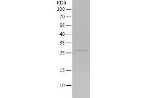 Western Blotting (WB) image for Golgin B1 (GOLGB1) (AA 18-218) protein (His tag) (ABIN7282388) (Golgin B1 (GOLGB1) (AA 18-218) protein (His tag))