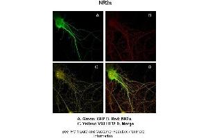 Sample Type :  Rat Hippocampal Neurons - 14DIV  Primary Antibody Dilution :  1:200  Secondary Antibody :  Anti-rabbit-Cy3  Secondary Antibody Dilution :  1:500  Color/Signal Descriptions :  Green: GFP Red: NR2a Yellow: VGLUT12  Gene Name :  GRIN2A  Submitted by :  Dan Fowler - University of Oregon, Institute of Neuroscience (NMDAR2A antibody  (Middle Region))