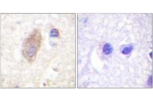 Immunohistochemistry analysis of paraffin-embedded human brain tissue, using Rabphilin 3A (Ab-Ser237) Antibody.