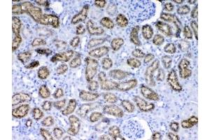 Immunohistochemistry (IHC) image for anti-Retinol Binding Protein 4, Plasma (RBP4) antibody (ABIN5647248)