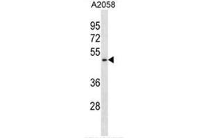 BFAR Antibody (N-term) western blot analysis in A2058 cell line lysates (35µg/lane). (BFAR antibody  (N-Term))