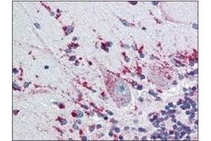Immunohistochemistry (IHC) image for anti-Cathepsin D (CTSD) (AA 21-412) antibody (ABIN317502) (Cathepsin D antibody  (AA 21-412))