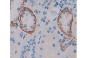 Figure. (RALBP1 antibody  (AA 403-499))
