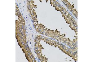 Immunohistochemistry of paraffin-embedded human prostate using SUMO3 antibody (ABIN5971585) (40x lens).
