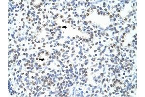 POGZ antibody was used for immunohistochemistry at a concentration of 4-8 ug/ml to stain Alveolar cells (arrows) in Human Lung. (POGZ antibody  (N-Term))