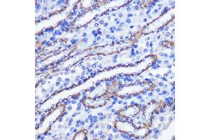 Immunohistochemistry of paraffin-embedded mouse kidney using PHLPP1 Rabbit pAb (ABIN6128434, ABIN6145573, ABIN6145574 and ABIN6225035) at dilution of 1:100 (40x lens). (PHLPP1 antibody  (AA 1508-1717))