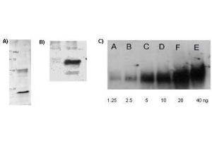 Western Blotting (WB) image for anti-Acetylated Lysine antibody (ABIN5596809)