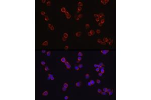 Immunofluorescence analysis of Jurkat cells using CD4 Rabbit pAb (ABIN3022124, ABIN3022125, ABIN3022126 and ABIN6218611) at dilution of 1:100 (40x lens). (CD4 antibody  (AA 300-400))