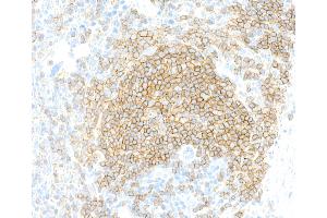 Immunohistochemistry (IHC) image for anti-CD19 Molecule (CD19) (AA 19-287) antibody (ABIN7455123) (Recombinant CD19 antibody  (AA 19-287))