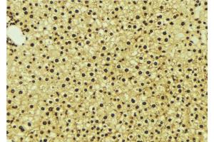 Immunohistochemistry (IHC) image for anti-Nuclear Receptor Subfamily 1, Group I, Member 3 (NR1I3) (Internal Region) antibody (ABIN6263717)