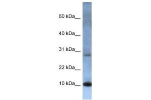 ATP5G2 antibody used at 1 ug/ml to detect target protein. (ATP5G2 antibody)
