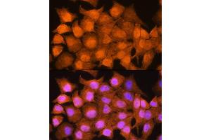 Immunofluorescence (IF) image for anti-Autoimmune Regulator (AIRE) (AA 30-130) antibody (ABIN3022515)