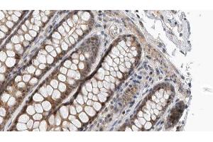 ABIN6276986 at 1/100 staining Rat colon tissue by IHC-P. (TAPBP antibody  (Internal Region))
