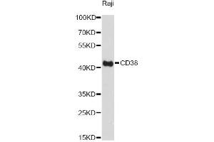 Western blot analysis of extracts of Raji cells, using CD38 Antibody. (CD38 antibody)
