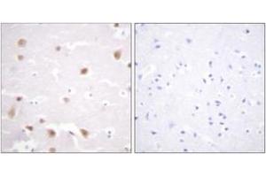 Immunohistochemistry (IHC) image for anti-Casein Kinase 2, beta (CSNK2B) (AA 166-215) antibody (ABIN2888808) (CSNK2B antibody  (AA 166-215))