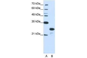 ANP32A antibody used at 1.
