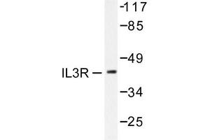 Image no. 2 for anti-Interleukin 3 Receptor, alpha (IL3RA) antibody (ABIN265478) (IL3RA antibody)