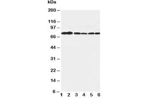 Western blot testing of B Raf antibody and Lane 1:  rat brain