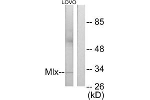Western blot analysis of extracts from LOVO cells, using Mlx antibody. (MLX antibody  (Internal Region))