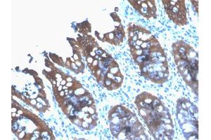 Formalin-fixed, paraffin-embedded human Colon stained with Cytokeratin 8 Mouse Recombinant Monoclonal Antibody (rB22. (Recombinant KRT8 antibody)