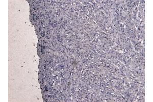 Immunohistochemistry (IHC) image for anti-Desmin (DES) (C-Term) antibody (ABIN334386)