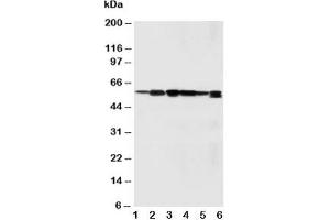 Western blot testing of SSH3BP1 antibody and Lane 1:  rat liver;  2: rat brain;  3: MM231;  4: HeLa;  5: SMMC-7721;  6: Jurkat cell lysate