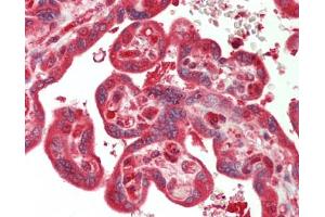 Immunohistochemistry (Paraffin-embedded Sections) (IHC (p)) image for anti-Carbamoyl-Phosphate Synthetase 2, Aspartate Transcarbamylase, and Dihydroorotase (CAD) (AA 1850-2000) antibody (ABIN2617836)