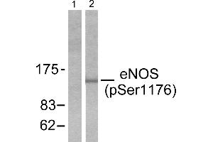 Western blot analysis of extracts from Hela cells treated with Insulin (0. (ENOS antibody  (pSer1176))