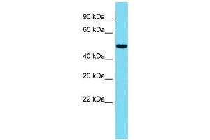 Host: Rabbit  Target Name: Gpatc2  Sample Tissue: Rat Spleen lysates  Antibody Dilution: 1. (GPATCH2 antibody  (C-Term))