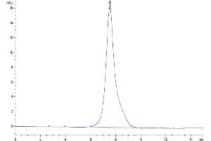 The purity of SARS-COV-2 Spike S1(B. (SARS-CoV-2 Spike S1 Protein (B.1.640) (His tag))