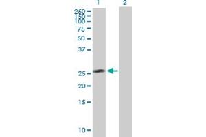 Western Blot analysis of CEP27 expression in transfected 293T cell line by CEP27 MaxPab polyclonal antibody. (HAUS2 antibody  (AA 1-235))