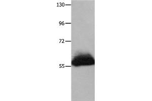 Western Blotting (WB) image for anti-Heparanase (HPSE) antibody (ABIN2428229) (HPSE antibody)