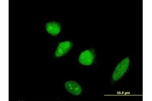 Immunofluorescence of monoclonal antibody to SCML2 on HeLa cell. (SCML2 antibody  (AA 251-350))
