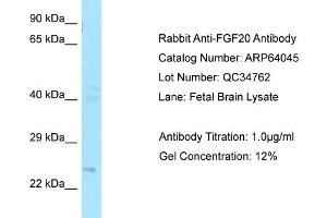 Western Blotting (WB) image for anti-Fibroblast Growth Factor 20 (FGF20) (C-Term) antibody (ABIN2789708) (FGF20 antibody  (C-Term))