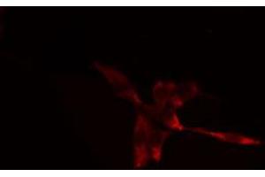 ABIN6274382 staining Hela cells by IF/ICC. (ZNF187 antibody  (Internal Region))