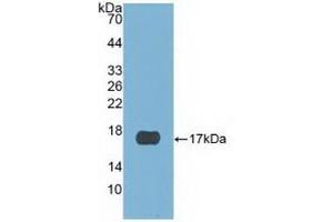 Detection of Recombinant CST6, Human using Polyclonal Antibody to Cystatin 6 (CST6) (CST6 antibody  (AA 29-149))