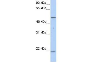 WB Suggested Anti-KRT10 Antibody Titration:  0.