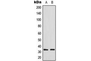 Western blot analysis of GDF15 expression in HepG2 (A), NIH3T3 (B) whole cell lysates. (GDF15 antibody  (Center))