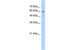 ATIC antibody used at 1. (ATIC antibody  (N-Term))