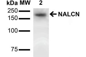 Western Blot analysis of Rat Brain showing detection of ~200 kDa NALCN protein using Mouse Anti-NALCN Monoclonal Antibody, Clone S187-7 .