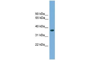 WB Suggested Anti-Hoxa1 Antibody Titration:  0. (HOXA1 antibody  (C-Term))