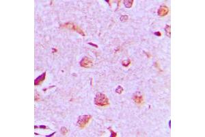 Immunohistochemical analysis of MAST3 staining in human brain formalin fixed paraffin embedded tissue section. (MAST3 antibody  (C-Term))