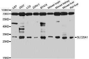 Western blot analysis of extract of various cells, using SLC25A1 antibody.