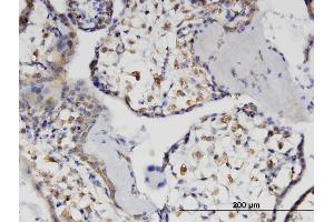 Immunoperoxidase of monoclonal antibody to HSH2D on formalin-fixed paraffin-embedded human placenta. (HSH2D antibody  (AA 251-352))