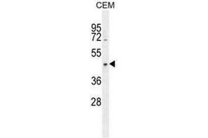 CCDC122 Antibody (C-term) western blot analysis in CEM cell line lysates (35µg/lane). (CCDC122 antibody  (C-Term))