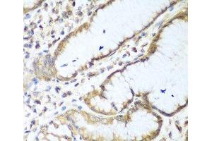 Immunohistochemistry of paraffin-embedded Human stomach using NUDT15 Polyclonal Antibody at dilution of 1:100 (40x lens). (NUDT15 antibody)